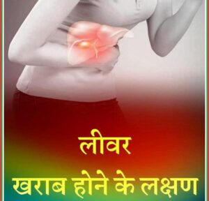 लीवर ख़राब होने के लक्षण 300x288 - लीवर ख़राब होने के लक्षण